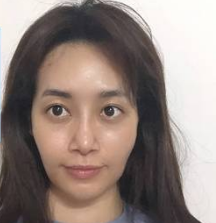 广州华美医疗美容整形医院张明兴抗衰老介绍