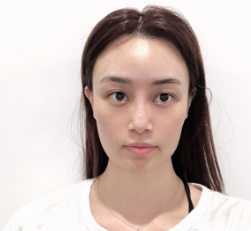 广州华美医疗美容整形医院张明兴抗衰老介绍