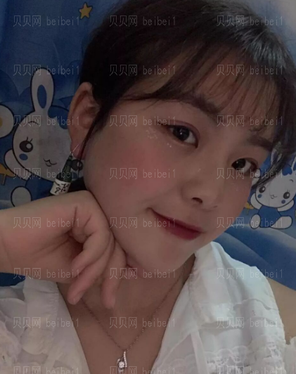 济南微著整形美容医院王晓璇介绍
