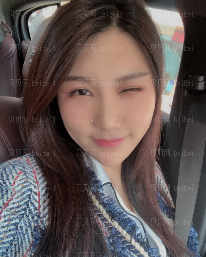 济南微著整形美容医院张鑫萌自体脂肪全脸填充介绍