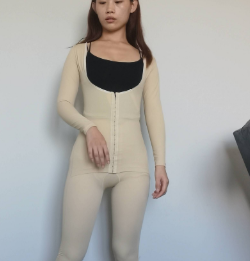 广州华美医疗美容整形医院郑志芳大腿吸脂介绍