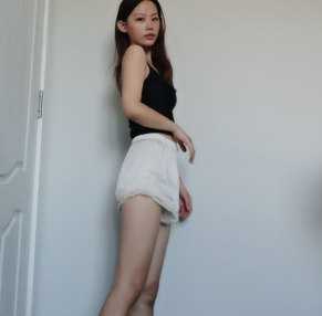 广州华美医疗美容整形医院郑志芳大腿吸脂介绍