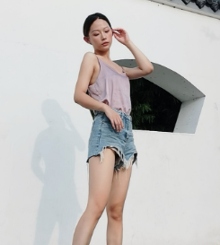 广州华美医疗美容整形医院郑志芳大腿吸脂介绍