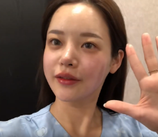 广州华美医疗美容整形医院郑志芳热拉提介绍