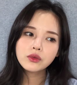 广州华美医疗美容整形医院郑志芳热拉提介绍