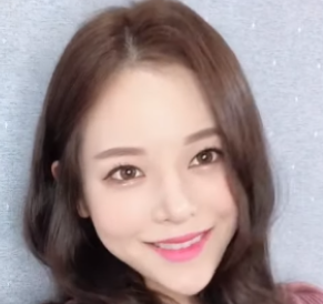 广州华美医疗美容整形医院郑志芳热拉提介绍