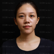 上海诗诺雅医疗美容医院李道源玻尿酸全脸填充介绍