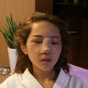 上海诗诺雅医疗美容医院陈小伟鼻部手术介绍 