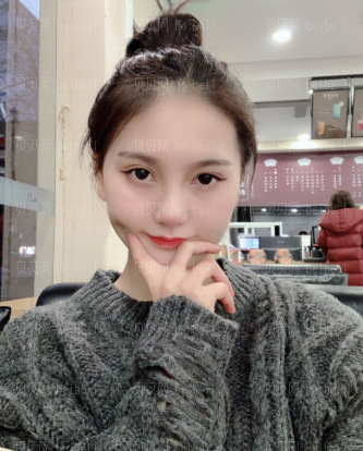 济南艺星整形医院杜娟 吸脂介绍