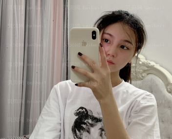 济南艺星整形医院杜娟 吸脂介绍