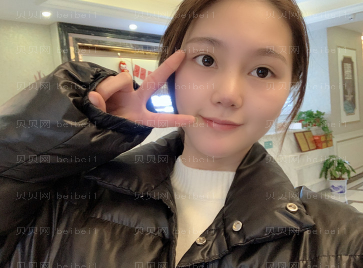 济南艺星整形医院杜娟 吸脂介绍