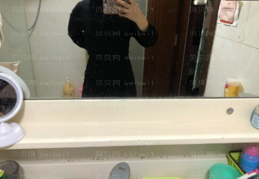 济南艺星整形医院杜娟 吸脂介绍