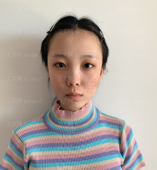 深圳晨曦医疗美容门诊部朱春艳自体脂肪填充介绍