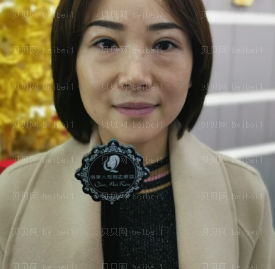 深圳晨曦医疗美容门诊部朱春艳祛眼袋介绍