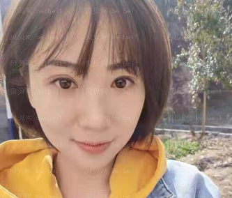 深圳晨曦医疗美容门诊部朱春艳祛眼袋介绍