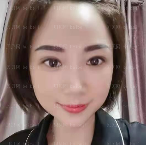 深圳晨曦医疗美容门诊部朱春艳祛眼袋介绍