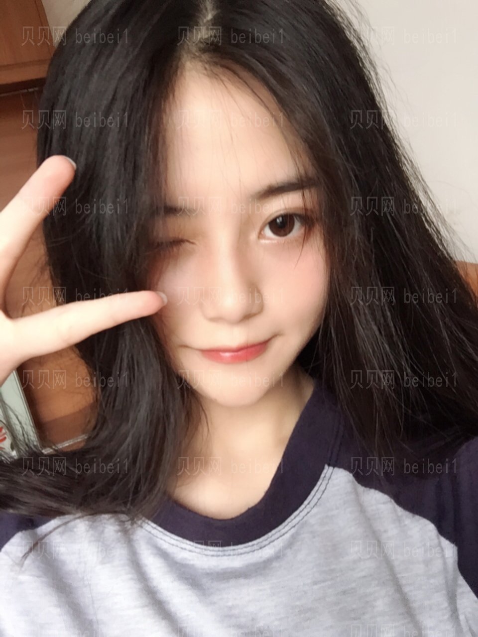 重庆美莱医师郑楠做的膨体隆鼻介绍分享，天仙鼻只花了10000！