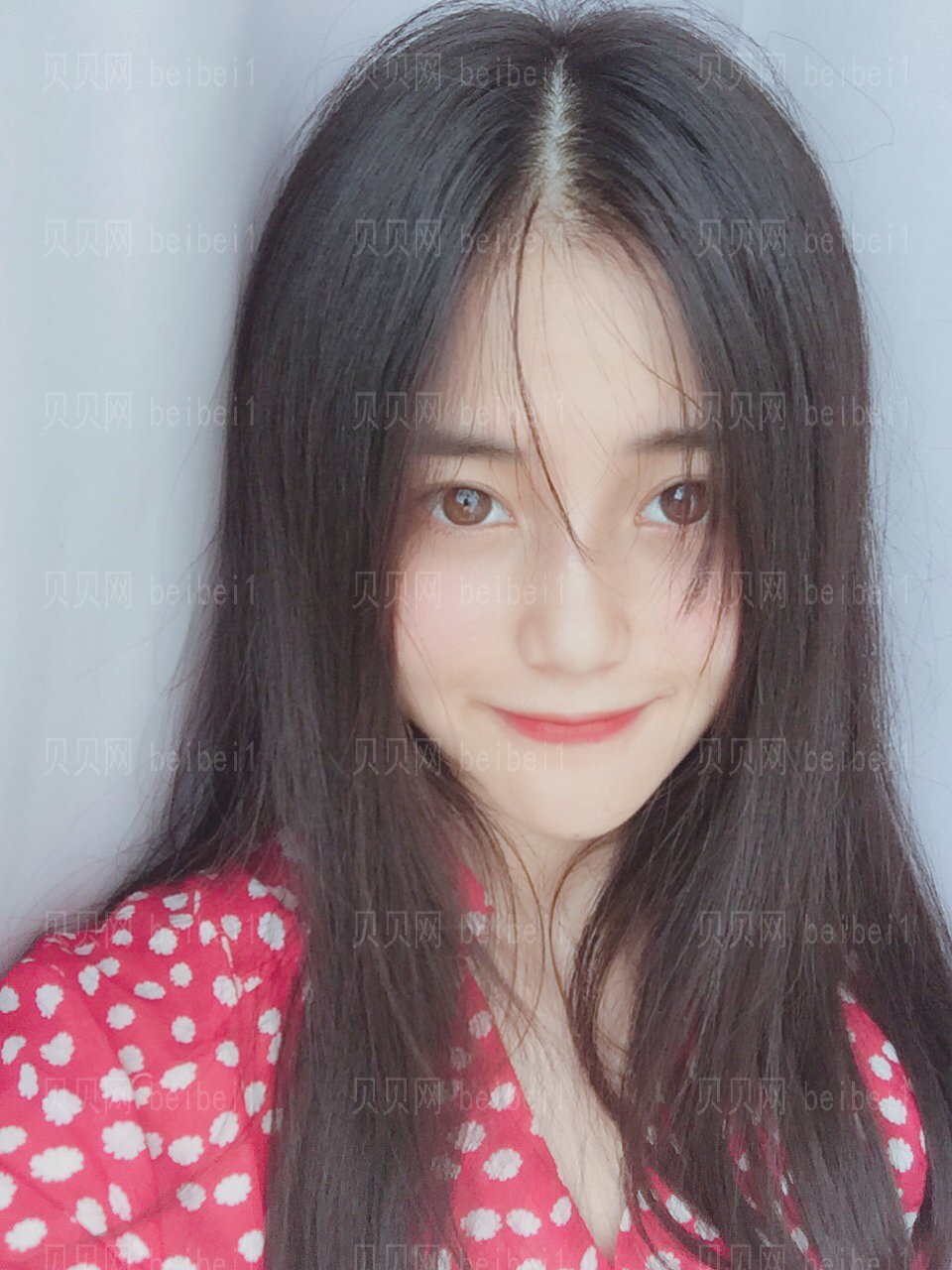 重庆美莱医师郑楠做的膨体隆鼻介绍分享，天仙鼻只花了10000！
