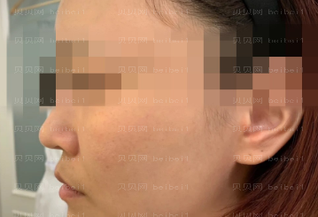 济南艺星医疗美容医院刘近兰热玛吉介绍片较新分享_全场感受下来真的很不错真心实意强烈名单！！哈哈