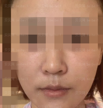 济南艺星医疗美容医院刘近兰热玛吉介绍片较新分享_全场感受下来真的很不错真心实意强烈名单！！哈哈