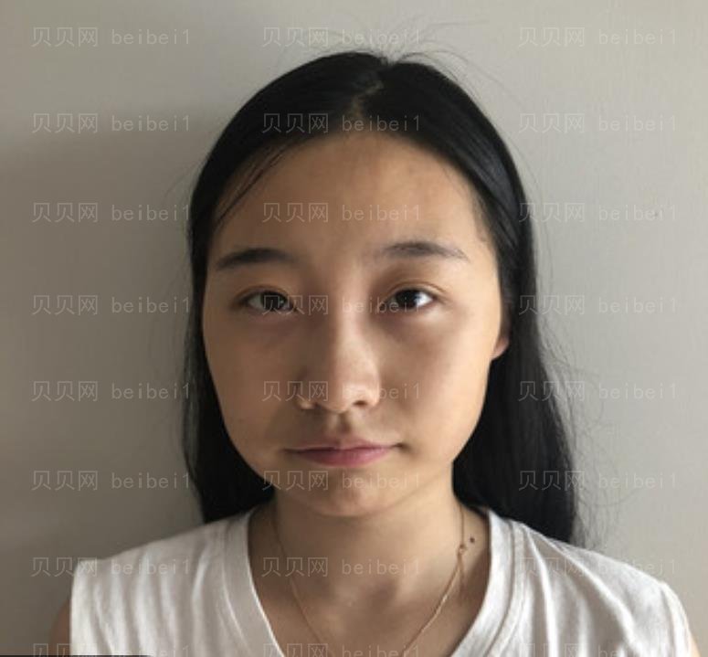 北京八大处整形外科技术怎么样,附磨骨瘦脸介绍果