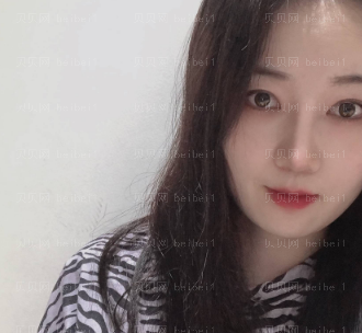 深圳华美整形医院李宁江隆鼻+重睑修复介绍片较新分享_照镜子都在想\为什么那么漂亮\!