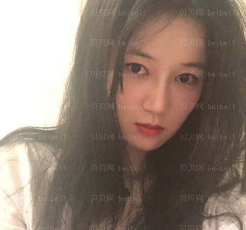 深圳华美整形医院李宁江隆鼻+双眼皮修复介绍片较新分享_盆友都说我愈来愈上镜了！