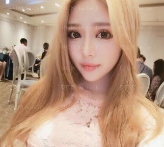 深圳和协门诊部李宝武双眼皮介绍片较新分享_过几天应该会更好看吧。