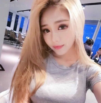 深圳和协门诊部李宝武双眼皮介绍片较新分享_过几天应该会更好看吧。
