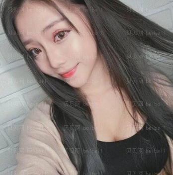 深圳和协门诊部李宝武双眼皮介绍片较新分享_过几天应该会更好看吧。