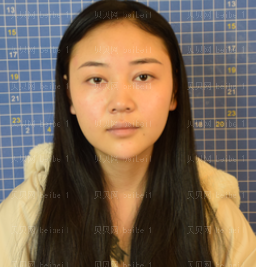 医深圳晨曦疗美容门诊部朱春艳半助鼻部手术介绍片果超好哦