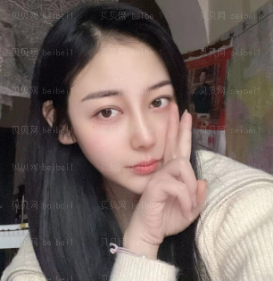 医深圳晨曦疗美容门诊部朱春艳半助鼻部手术介绍片果超好哦