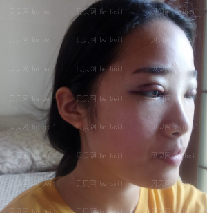 深圳美莱医疗美容整形医院官有会双眼皮介绍片较新分享_保险起见,我决定还是1个月后再化妆吧。