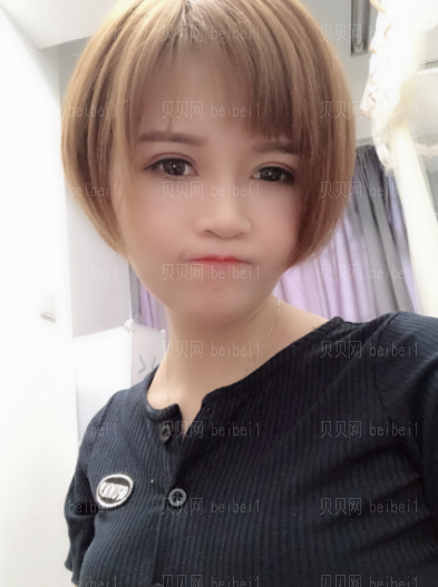  深圳博爱医院整形美容中心景熙翔平行双眼皮介绍片,多了1份娇俏感