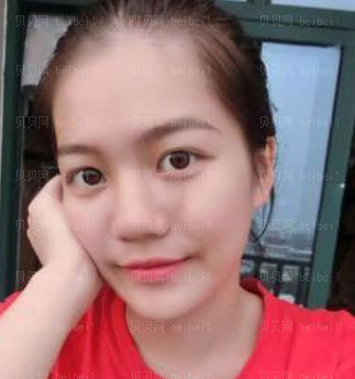深圳美莱医疗美容整形医院林登文隆鼻介绍片较新分享 鼻子更好看啦!