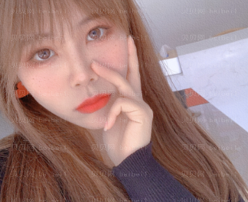 深圳美莱医疗美容整形医院林登文隆鼻介绍片较新分享_完全看不出手术的痕迹,hen令人满意~~