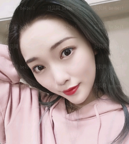 深圳雅涵医疗美容医院侯文明假体垫下巴介绍片较新分享——下巴还是一样的稳定,美美哒