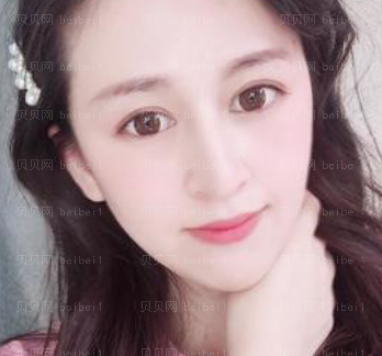 深圳美莱医疗美容整形医院杨鹏祛斑介绍片较新分享_我恢复得很好,脸部干净了,人都漂亮了许多