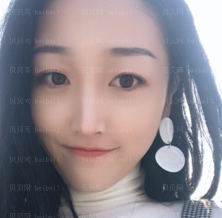 深圳美莱医疗美容医院梁晓健双眼皮+开眼角介绍片较新分享_早点变为美少女。哇哈哈哈