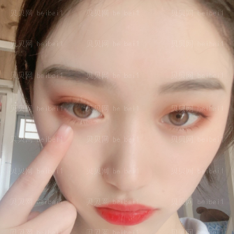深圳美莱医疗美容医院梁志为双眼皮介绍片较新分享_走到哪里几乎都是众人的聚焦点!
