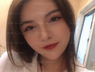 深圳丽港丽格医疗美容医院石东文眼修复介绍片较新分享_我较为喜欢这样的双眼皮~哈哈哈