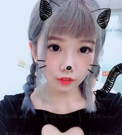 深圳伊婉医疗美容门诊部王力佳双眼皮介绍片较新分享——现在的眼睛看起来比之前更加自然了,线条也还是很流畅的