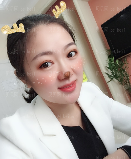 深圳易容颜医疗美容门诊部魏晓峰双眼皮介绍片较新分享——真的感觉自己较近是越来越好看了,果然漂亮的眼睛都是双眼皮居多啊