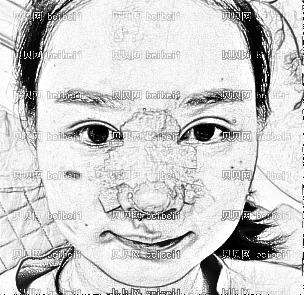 深圳睿京医疗美容整形医院王海半助隆鼻介绍片医生手法好好啊