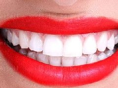冷光美白损伤大牙吗?牙齿到底能变多白?冷光牙齿美白的果能保持多久?
