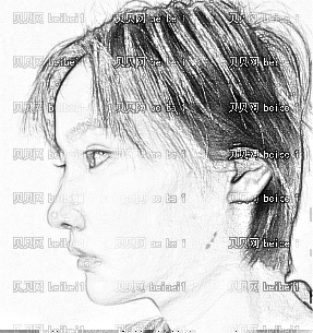 深圳希思医疗美容医院李俊鼻部修复介绍片嘿嘿这次做的太成功了