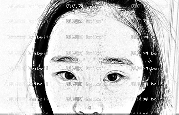 深圳流花医院整形美容科段涛眼部综合介绍片较新分享_双眼皮儿还在恢复期但也变得ziran了不少呢!