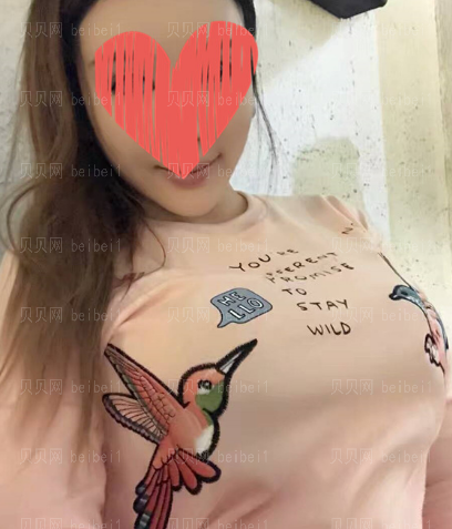 深圳阳光整形美容医院陈星光复合隆胸介绍片较新分享——现在的果超出我的预期，简直不要太棒了