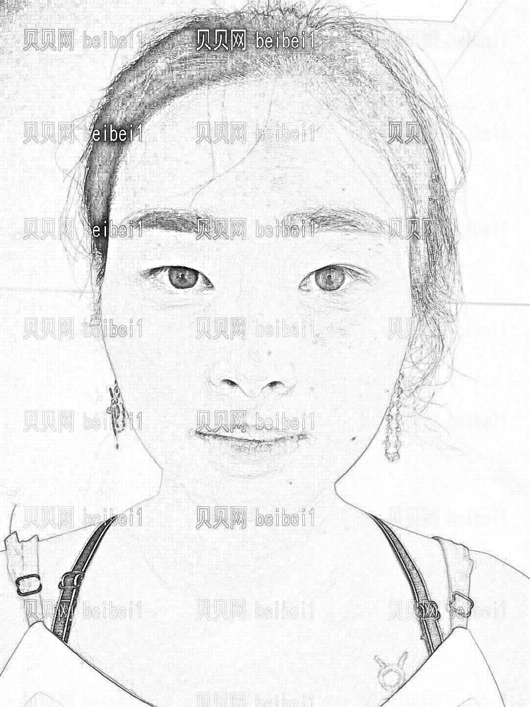 深圳非凡医疗美容医院易培金眼部手术介绍分享~从此眼睛无神变有神