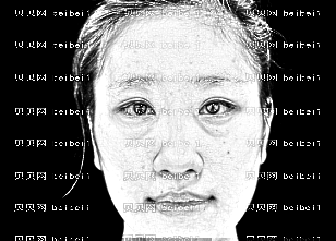 深圳科美丽格医疗美容门诊部何德文双眼皮全切+外切眼袋介绍片较新分享_慢慢等着，变得越来越自然的。